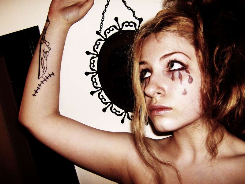 Stitches